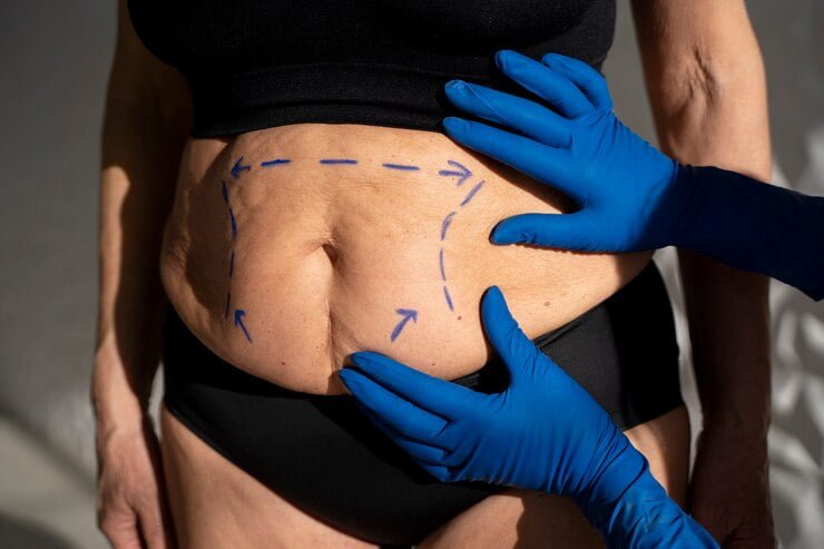 Introduction to Gastric Sleeve Surgery And What You Need To Know About It