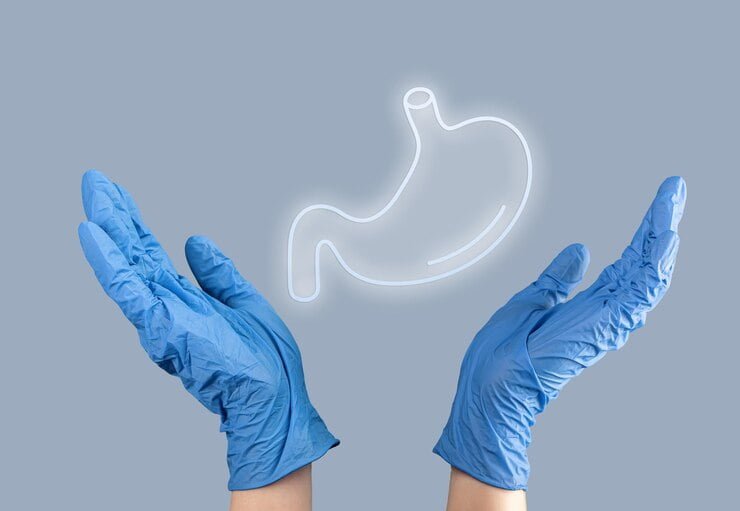 Endoscopic Gastric Sleeve