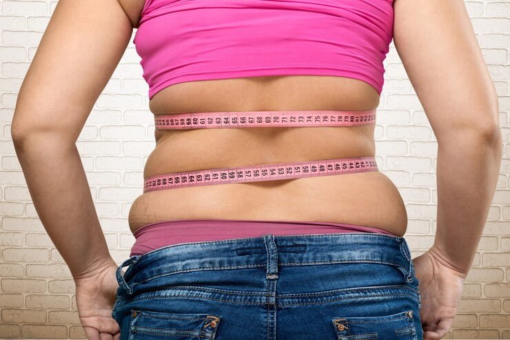 Weight regain after surgery